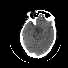 Miniatura de serie