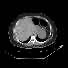 Miniatura de serie